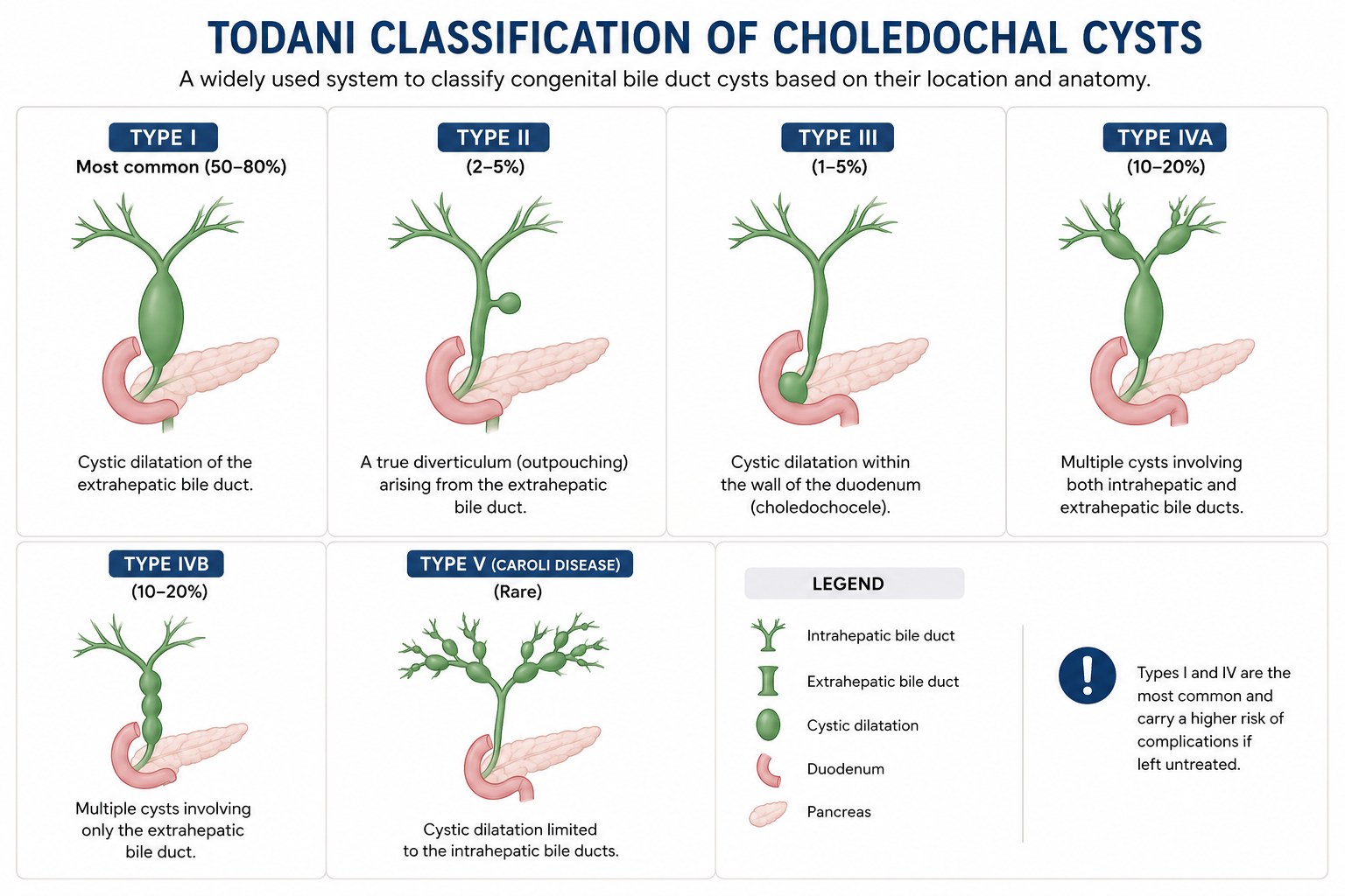 Types of Choledochal cysts
